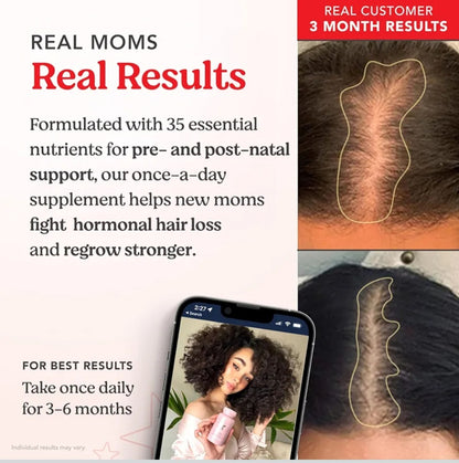 HAIRtamin Mom Formula
